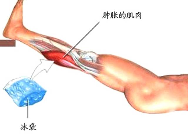 运动神经元病针灸康复视频,运动损伤针灸治疗方法举例
