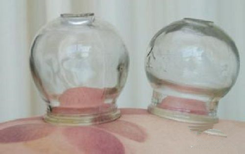 怎么通过拔罐的颜色判断身体状况,肩膀拔罐后颜色黑紫是怎么回事