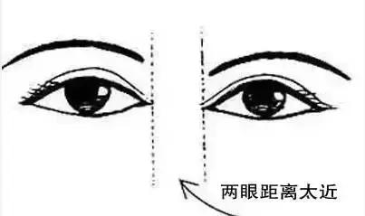 开内眼角和外眼角哪个好看,外眼角上扬适合开外眼角吗