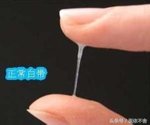 白带异常的各种表现,白带异常什么情况下出现
