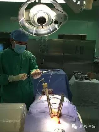 北京腰椎骨折微创手术,北京骨科大腿骨头骨折手术
