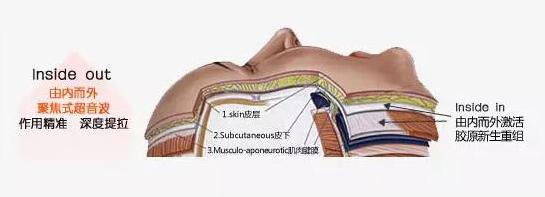 超声刀讲解视频,超声刀的资料与知识