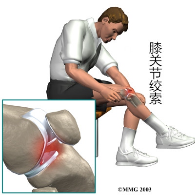 运动后修复膝盖喷雾,膝盖长期运动受损怎么办