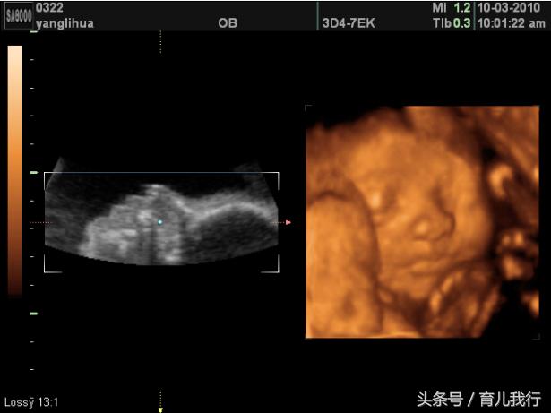 四维顺利归来宝宝健康吗,四维归来顺利通过吗