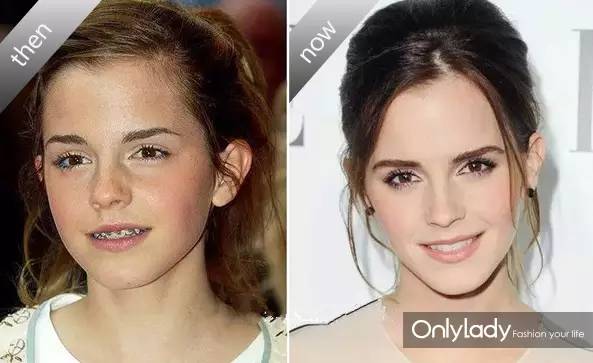 希拉里牙齿怎么样,希拉里的女儿怎么样