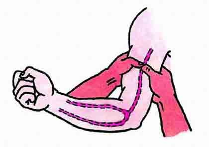外伤急救的注意事项,急救知识伤口少量出血怎么处理