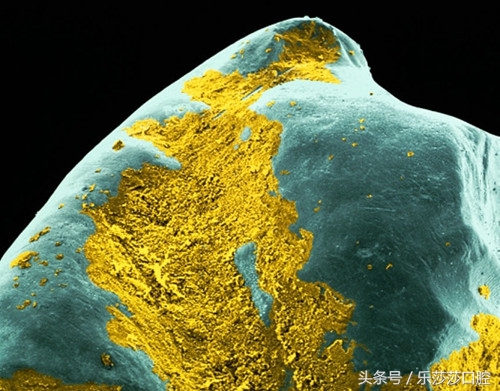 牙医能辨别出换过没换过的牙齿吗,牙医见过最好的牙齿是怎么样的