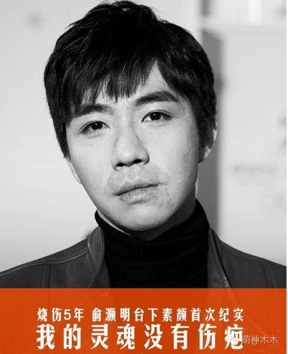 俞灏明烧伤后恢复了吗,被烧伤前的俞灏明照片