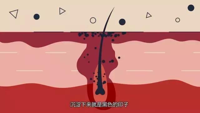 协和治疗黑头粉刺,协和医院皮肤科黑头