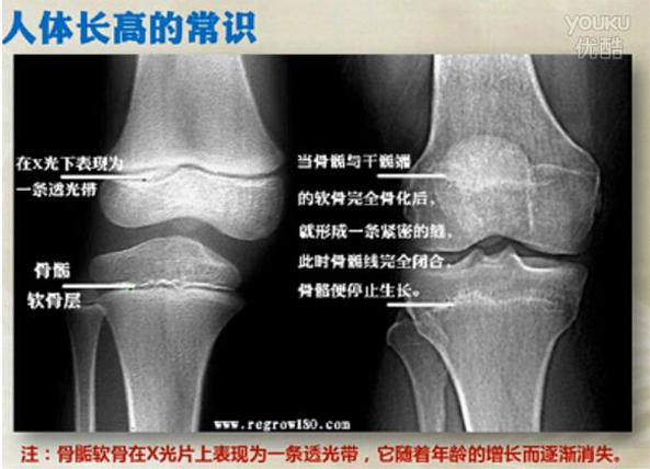 长高重要知识,长高科学原理