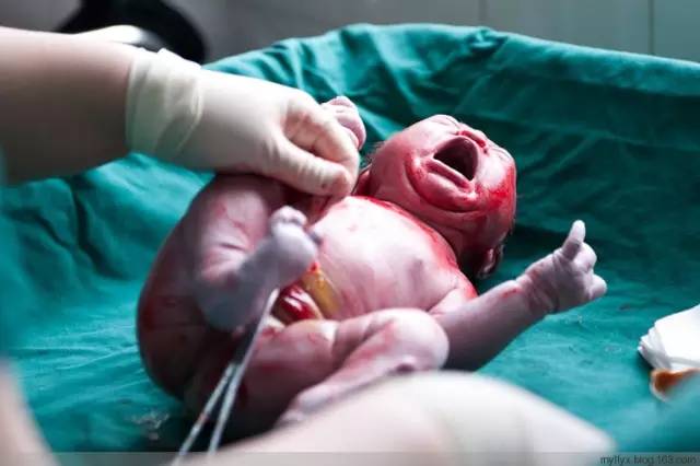 剖腹产恢复很好的照片,剖腹产完全恢复照片