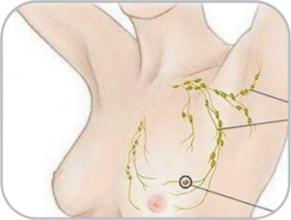 淋巴的中医养生知识,淋巴是如何解毒的