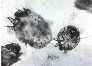 疥疮有什么更好的方法可以拯救,疥疮治愈的小妙招