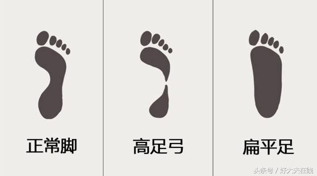 走路脚好疼该怎么安慰,走路多了脚疼跟鞋有关系吗