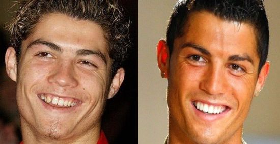 为什么明星的牙齿那么白那么整齐,为什么明星抽烟牙齿还那么白