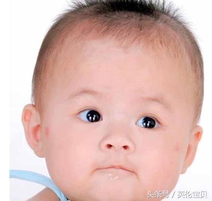 宝宝湿疹妈妈的心酸,宝妈战胜湿疹的经验