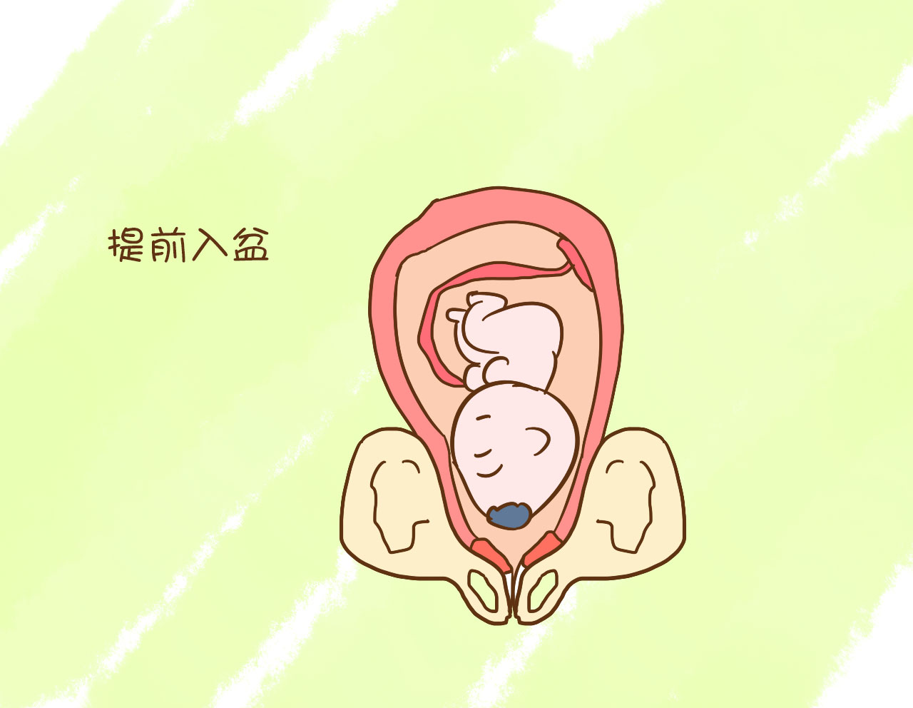 胎儿半入盆和全入盆有什么不同,36周胎儿半入盆正常吗