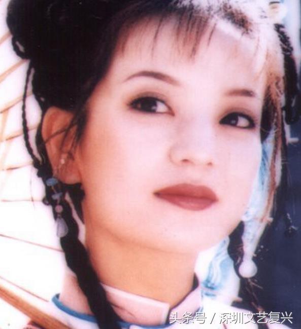 林允整牙效果怎么样,林允整牙后变化图片