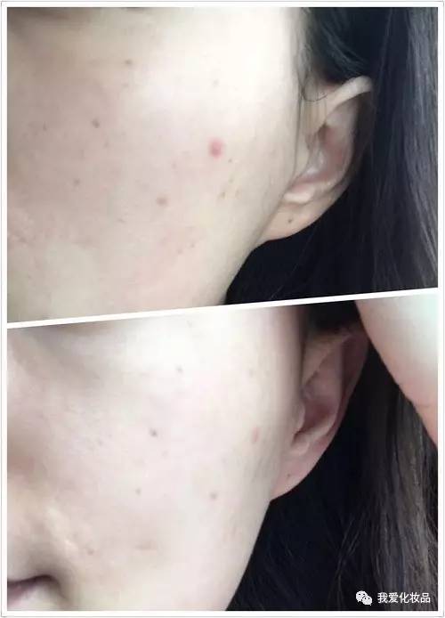 韩国四部曲护肤顺序,韩国护肤四部曲