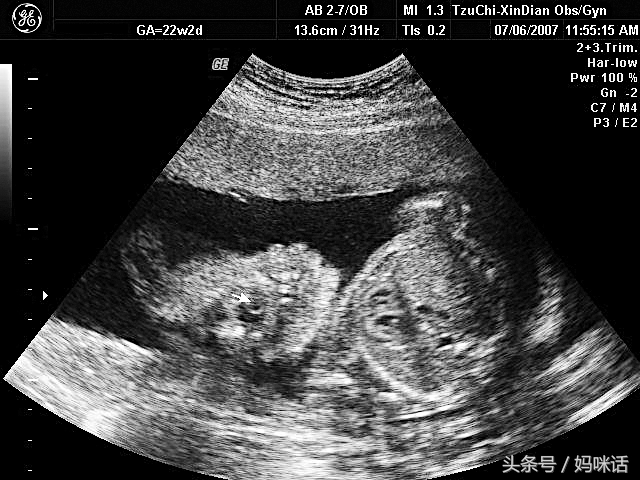 怀孕宝典软件哪个好用,怀孕宝典哪个好