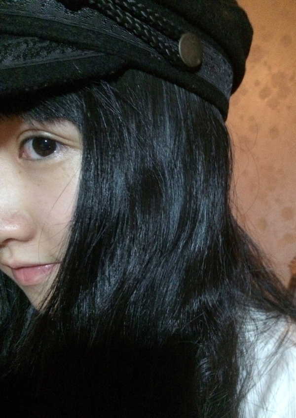 抽脂双眼皮做完眼睛有褶,割双眼皮肿成一条缝