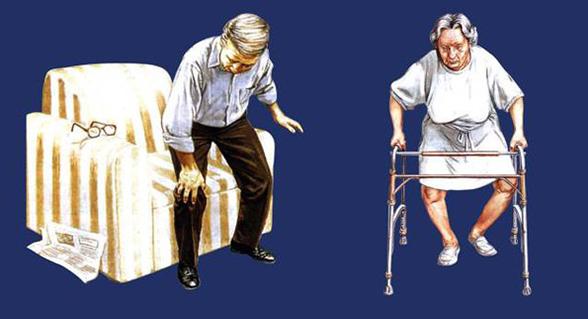 澳洲维骨力关节灵简介,澳洲最新关节炎治疗与研究