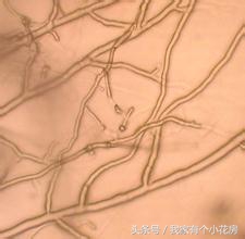 食用菌蘑菇种植技术发展史,食用菌蘑菇叫什么