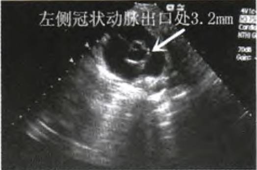 儿童发热不及时就诊会有什么后果,儿童不明原因发烧不退