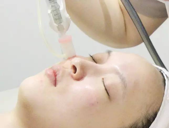 双眼皮手术韩式整形,韩国医生做幽灵手术