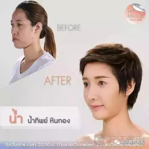 泰国专门的整容节目,泰国的整容节目有哪些