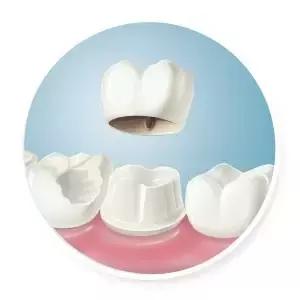 整牙刘涛,整牙改变脸型杨幂