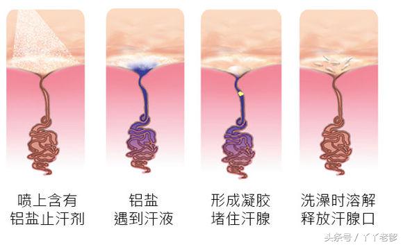 关于狐臭你应该知道的小秘密,狐臭科普视频