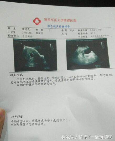 怀孕45天出血怎么判断宫内宫外,孕早期出血多要去挂急诊吗