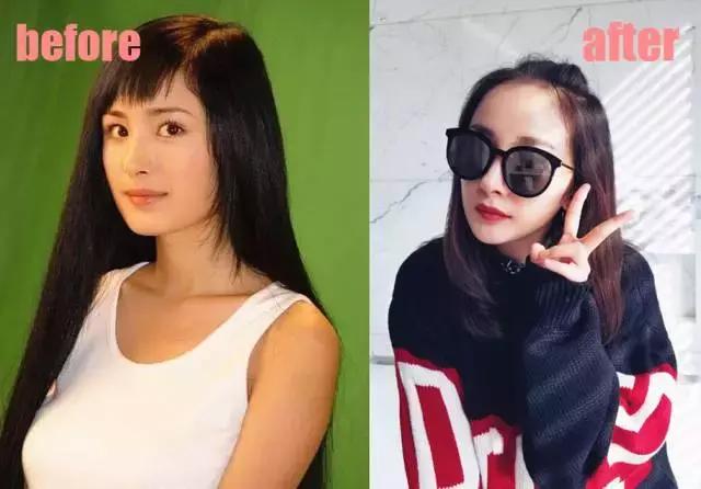 整牙=整容?看杨幂、刘涛、高圆圆为你亲身示范!