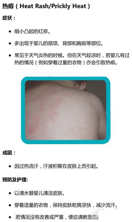 湿疹or热痱，傻傻分不清!八种宝宝常见皮肤问题及护理指南