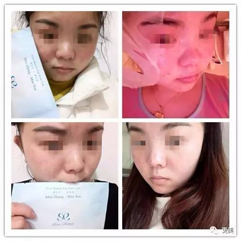 明星卖黑心面膜赚28亿,明星卖面膜