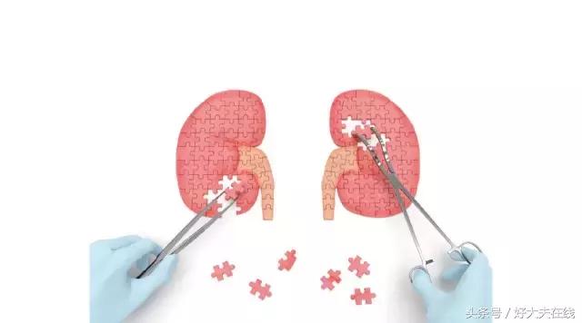 肾结石一公分输尿管能自己排出吗,6*5毫米的肾结石能自己排出吗