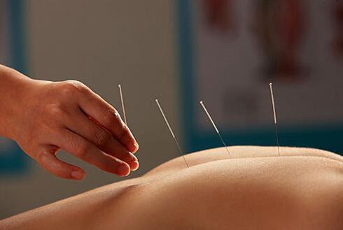 针灸治疗中风的讲座,董氏针灸对中风后遗症有用吗