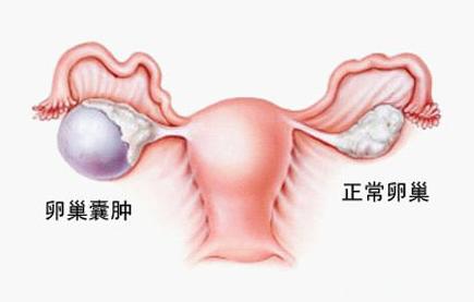 怀不上孕女性做什么检查,怀不上孩子女性查什么