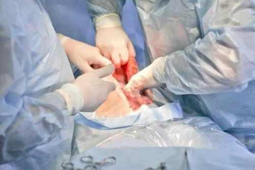 女人顺产和剖腹产有什么区别,女人生产产程短好还是产程长好