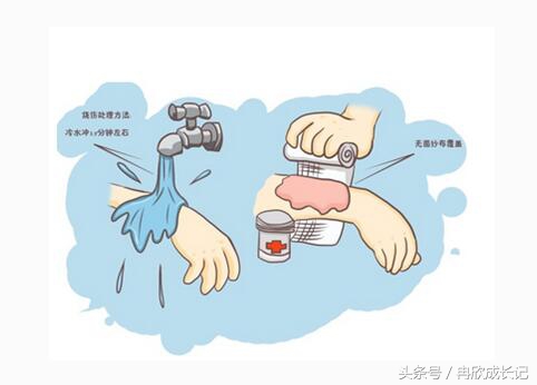 面对宝宝烫伤,亲们千万不慌,谨记宝宝烫伤的最佳处理时间