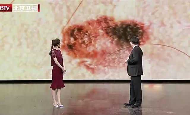 黑色素瘤突破真皮层,黑色素瘤是癌症的几率有多少