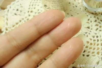 脾胃虚寒气血不足有哪些表现症状,男人气血不足的10个症状怎么调理