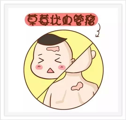 胎记好坏图片大全,孩子有胎记一般都是怎么造成的