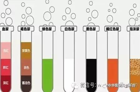 看尿液颜色判断身体有多少水,通过尿液颜色也能辨健康