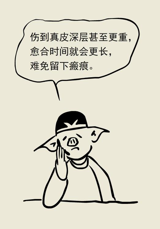 做饭时被热油烫伤怎么办,做饭被油烫伤了怎么办会留疤吗