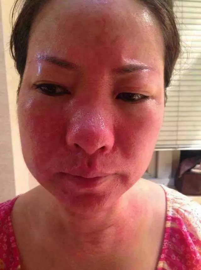 面膜被曝光,面膜里会含有毒品成分吗