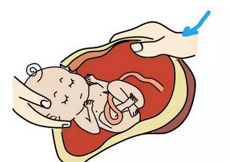 协和剖腹产怎么预约,协和剖腹产要按肚子吗