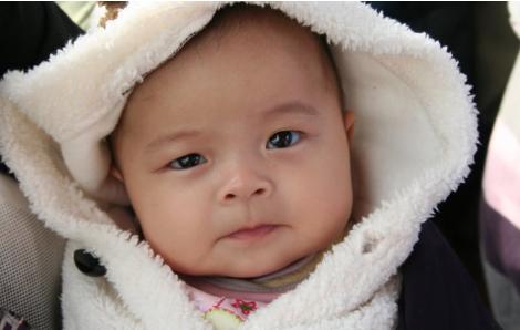 小孩出湿疹最好的解决办法,孩子湿疹更需要被重视