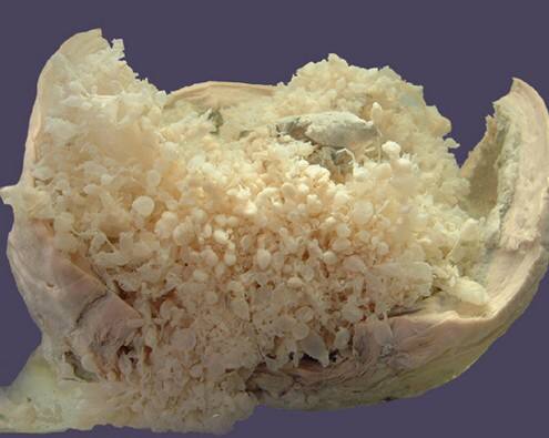 孕早期症状有哪些如何自我检测,孕早期后背疼痛怎么回事